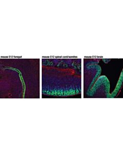 Cell Signaling Sox2 (D9b8n) Rabbit mAb