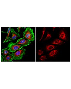 Cell Signaling Calnexin (C5c9) Rabbit mAb (Alexa Fluor 555 Conjugate)