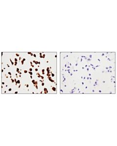 Cell Signaling Sqstm1/P62 (D6m5x) Rabbit mAb (Rodent Specific)