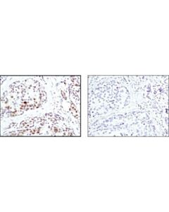 Cell Signaling Phospho-Mapk/Cdk Substrates (Pxs*P Or S*Pxr/K) (34b2) Rabbit mAb