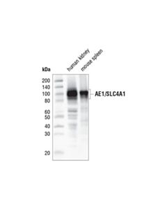 Cell Signaling Ae1/Slc4a1 (D3x1r) Rabbit mAb