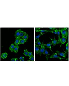 Cell Signaling Merlin/Ezrin/Radixin/Moesin (D1p8i) Rabbit mAb