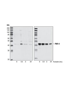 Cell Signaling Phospho-Par-4 (Thr163) Antibody