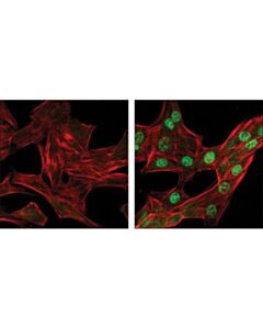 Cell Signaling Phospho-Chk1 (Ser345) (133d3) Rabbit mAb
