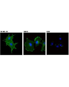 Cell Signaling Na,K-Atpase Alpha1 (D4y7e) Rabbit mAb