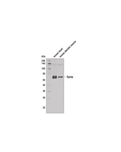 Cell Signaling Synip (C51g6) Rabbit mAb