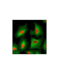 Cell Signaling Hsp27 (G31) Mouse mAb