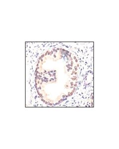 Cell Signaling P14 Arf (4c6/4) Mouse mAb