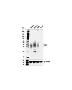 Cell Signaling Sit Antibody