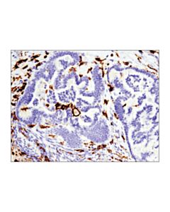 Cell Signaling Cd16 (D1n9l) Rabbit mAb