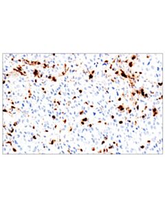 Cell Signaling Eosinophil Cationic Protein (E6u5m) Rabbit mAb