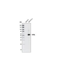 Cell Signaling ATGL (30A4) Rabbit mAb 20 uL