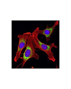 Cell Signaling Pdi Antibody