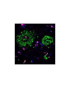 Cell Signaling App/Beta-Amyloid (Nab228) Mouse mAb