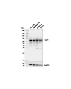 Cell Signaling GBP2 (F5H3U) Rabbit mAb; 20 µl