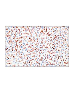 Cell Signaling Cd206/Mrc1 (E6t5j) Xp Rabbit mAb