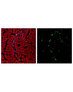Cell Signaling Cd206/Mrc1 (E6t5j) Xp Rabbit mAb