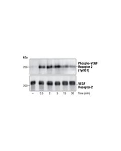 Cell Signaling Phospho-Vegf Receptor 2 (Tyr951) Antibody
