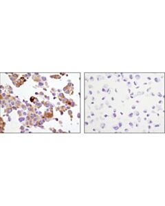 Cell Signaling Psa/Klk3 (D11e1) Xp Rabbit mAb
