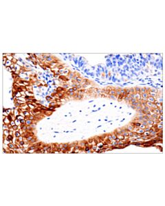 Cell Signaling Cd109 (E4i2v) Rabbit mAb