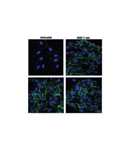 Cell Signaling Phospho-Vegf Receptor 2 (Tyr1175) (19a10) Rabbit mAb