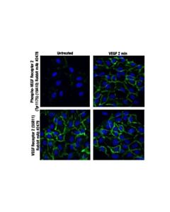 Cell Signaling Phospho-Vegf Receptor 2 (Tyr1175) (19a10) Rabbit mAb