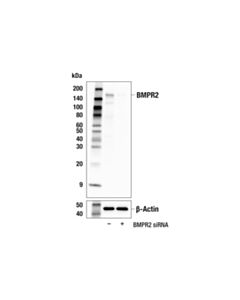 Cell Signaling BMPR2 (E9U5C) Rabbit mAb