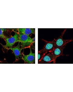 Cell Signaling Foxo3a (75d8) Rabbit mAb
