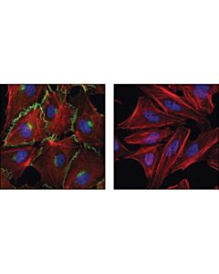 Cell Signaling Ve-Cadherin (D87f2) Xp Rabbit mAb