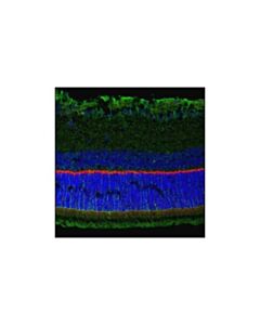 Cell Signaling Psd95 Antibody