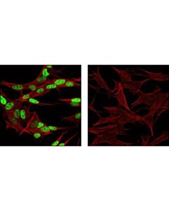 Cell Signaling Ap-2beta Antibody
