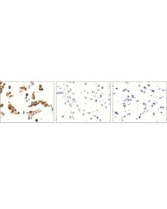Cell Signaling Trka (12g8) Rabbit mAb