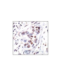 Cell Signaling Phospho-Estrogen Receptor Alpha (Ser118) (16j4) Mouse mAb