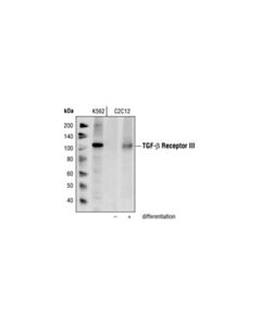 Cell Signaling Tgf-Beta Receptor Iii Antibody