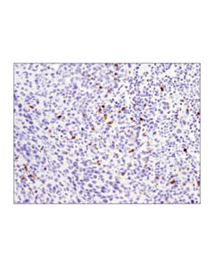 Cell Signaling Cd4 (D7d2z) Rabbit mAb