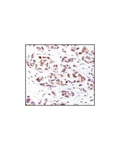 Cell Signaling Phospho-P53 (Ser33) Antibody