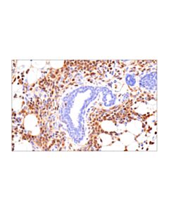Cell Signaling Slp-76 (E4n7e) Rabbit mAb