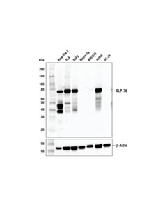Cell Signaling SLP-76 (E4N7E) Rabbit mAb 20 uL