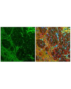 Cell Signaling Phospho-Tau (Thr205) (E8q5z) Mouse mAb