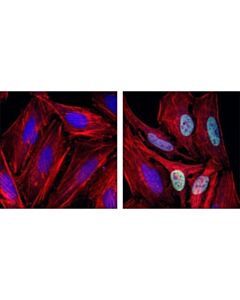 Cell Signaling P57 Kip2 Antibody