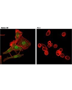 Cell Signaling Stat5 (D3n2b) Rabbit mAb