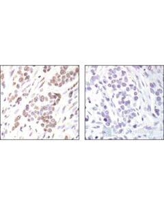 Cell Signaling Acetyl-Histone H2b (Lys20) Antibody