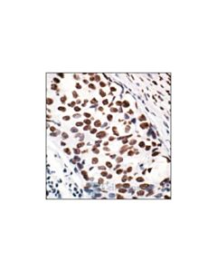 Cell Signaling Acetyl-Histone H2a (Lys5) Antibody