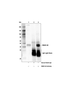 Cell Signaling Mage-A3 Antibody