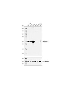 Cell Signaling Keratin 5 (D4U8Q) Rabbit mAb 20 uL