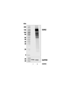 Cell Signaling DDR2 (E6V2N) Rabbit mAb 100 uL
