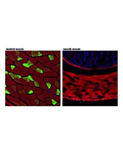 Cell Signaling Myoglobin (D2f5x) Rabbit mAb