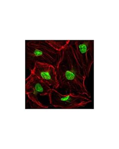 Cell Signaling Nup98 (C39a3) Rabbit mAb