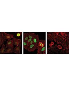 Cell Signaling Phospho-Hp1gamma (Ser83) Antibody