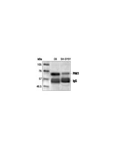 Cell Signaling Pak1 Antibody
